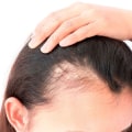 El poder de la vitamina A para una piel y un cabello saludables