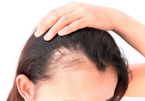 El poder de la vitamina A para una piel y un cabello saludables