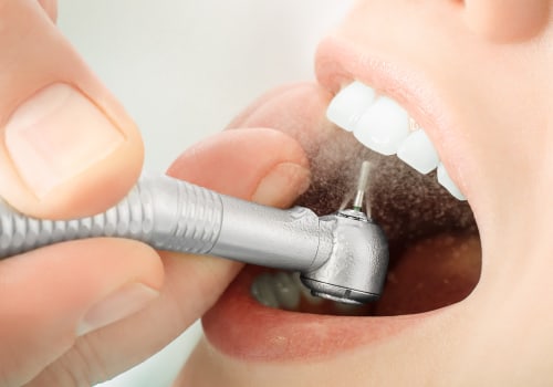La importancia de la limpieza dental profesional para la salud en general